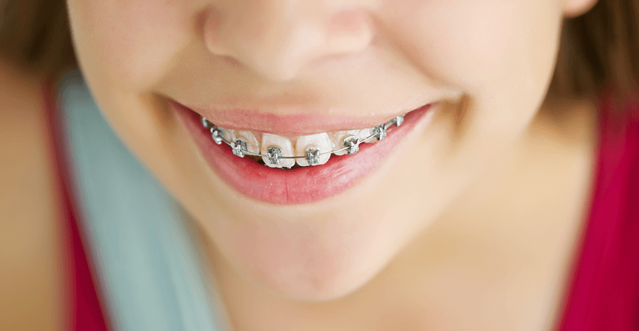 /upload/files/277/child-orthodontics-14142.png